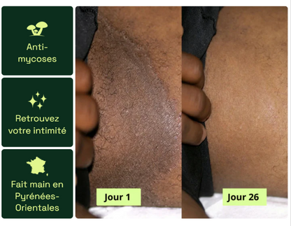 Nola® Savon Purifiant Antifongique