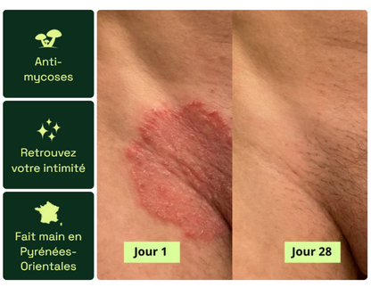 Nola® Savon Purifiant Antifongique