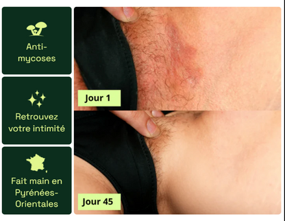 Nola® Savon Purifiant Antifongique