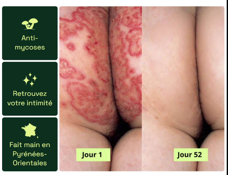 Nola® Savon Purifiant Antifongique
