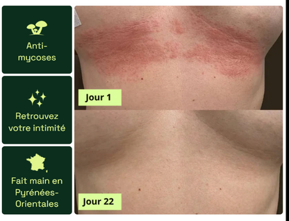 Nola® Savon Purifiant Antifongique